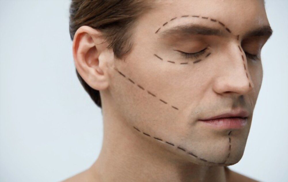 Istanbul Facial Plastic Surgery